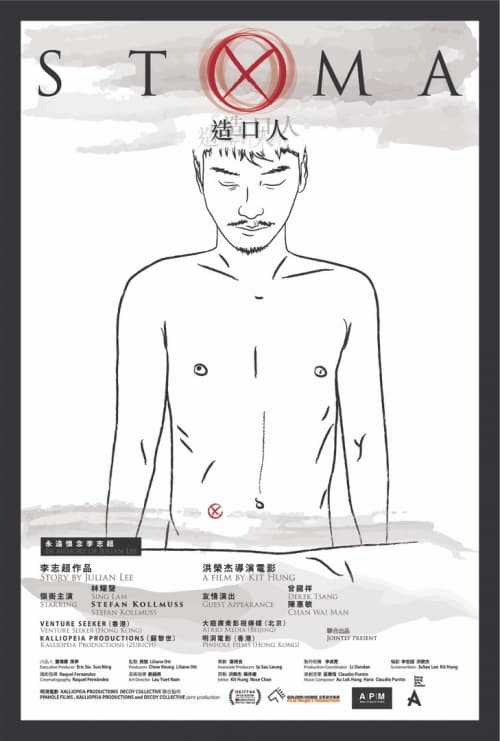 造口人
